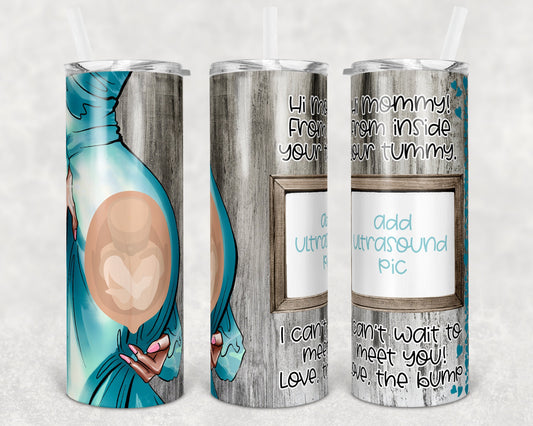 20 oz Skinny Tumbler Picture Frame Tumbler Pregnant mom Photo New Mom Sublimation Design